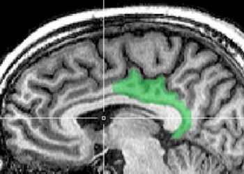 MRI may predict progression to dementia in healthy elderly adults
