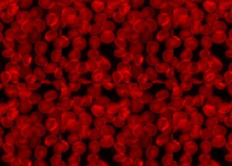 Blood type correlates with egg reserve in infertile women