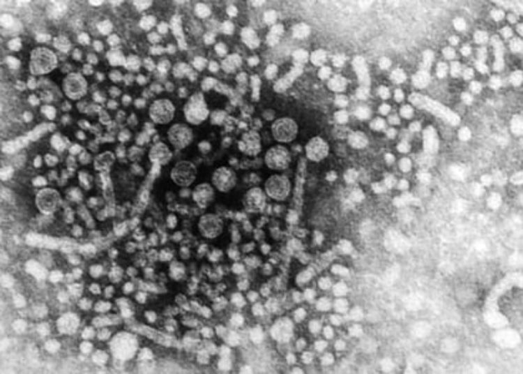[CORAL-1 trial] Interferon-free regimen for recurrent hepatitis C after liver transplant safe and effective