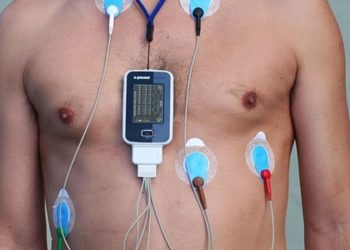 Atrial fibrillation-specific management increases days alive and out of hospital