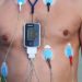 Atrial fibrillation-specific management increases days alive and out of hospital