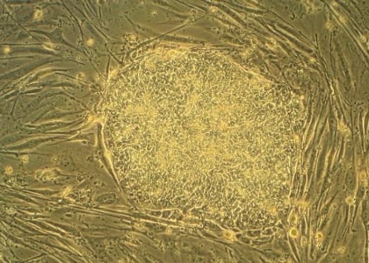 Modified embryonic stem cells may prolong survival of surgical grafts