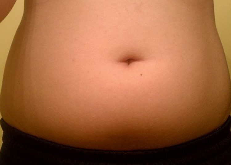 Majority of obese tenth-graders already obese by fifth grade