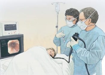 Patient Basics: Esophageal Cancer