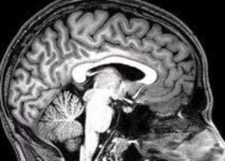 Abusive head trauma results in fewer productive life-years