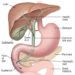 Patient Basics: Gallbladder and Bile Duct Cancer