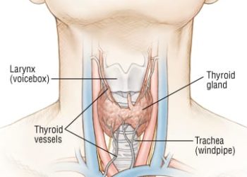 Patient Basics: Graves’ Disease
