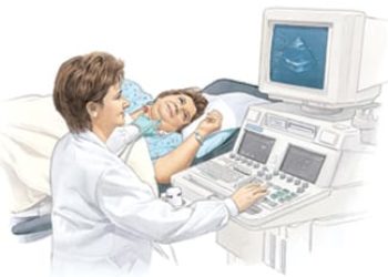 Patient Basics: Heart Attack (Myocardial Infarction)