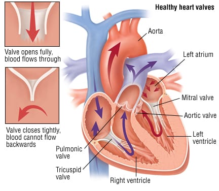Patient Basics: Heart Valve Replacement | 2 Minute Medicine