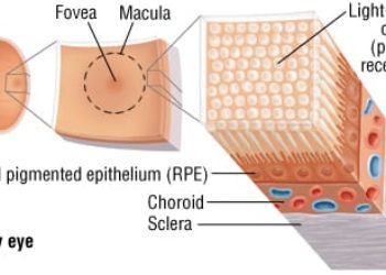 Patient Basics: Macular Degeneration