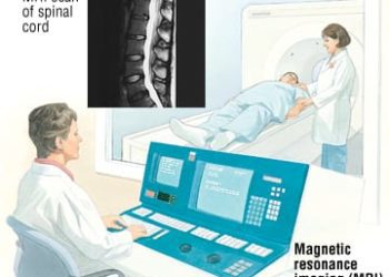 Patient Basics: Magnetic Resonance Imaging (MRI)