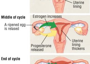 Patient Basics: Menopause And Perimenopause