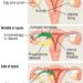 Patient Basics: Menopause And Perimenopause