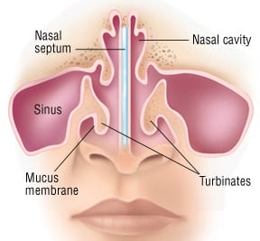 Nose bleed cheap from sinus