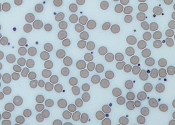 Long-term dual antiplatelet therapy does not increase mortality risk