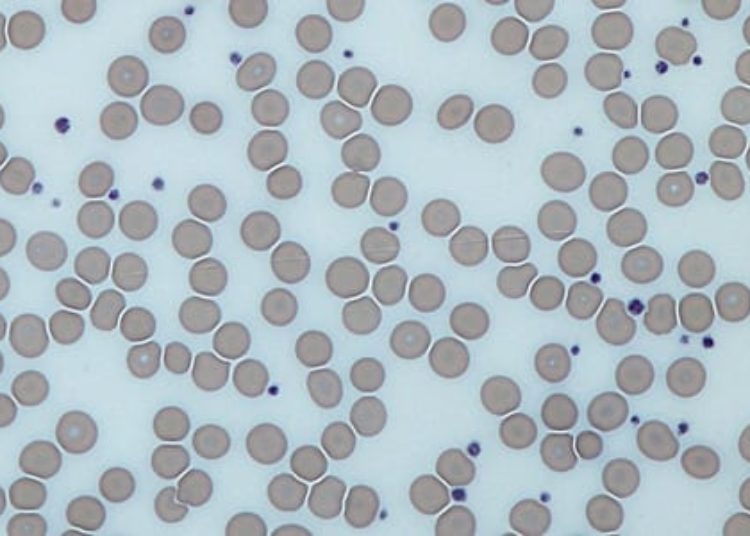 Long-term dual antiplatelet therapy does not increase mortality risk