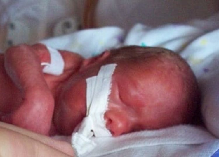 Cervical conization may double risk of preterm birth
