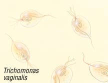 Trichomoniasis1