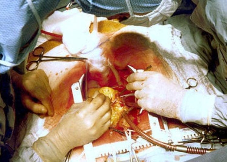 No benefit of adding mitral valve repair to CABG