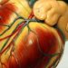 β-blockers linked to improved survival in preserved ejection fraction heart failure