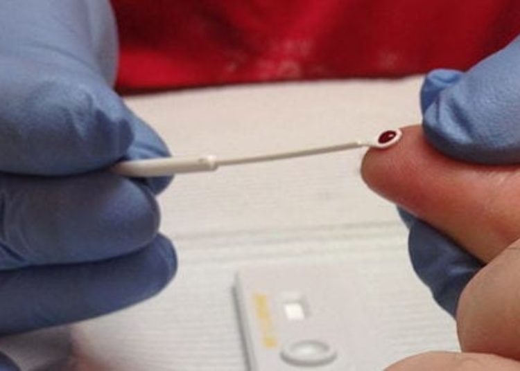 Delayed antiretroviral therapy initiation linked to decreased immunologic recovery in HIV