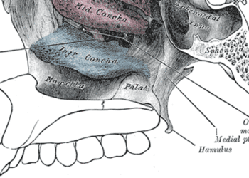 Possible risk factors for sphenoid sinus tumor recurrence identified