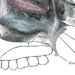 Possible risk factors for sphenoid sinus tumor recurrence identified