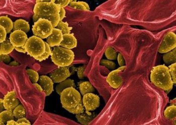 Obstetric scoring systems overestimate cases of severe sepsis