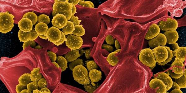 staph sepsis