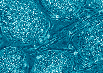 Engineered stem cells mitigate liver damage caused by radiation [PreClinical]