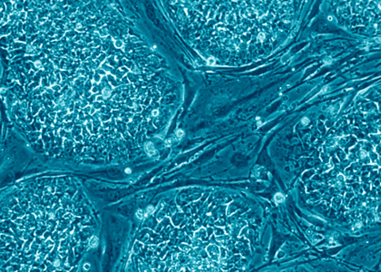 Engineered stem cells mitigate liver damage caused by radiation [PreClinical]