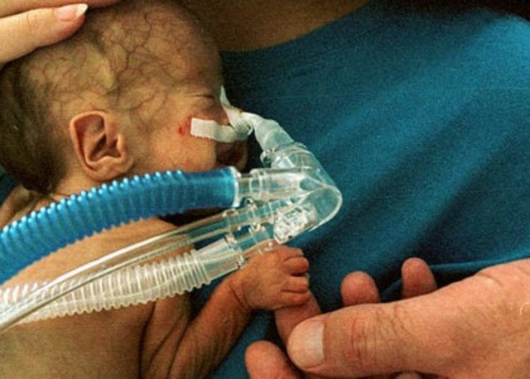 No decrease in infant mortality with maternal micronutrient supplementation in Bangladesh