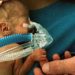 No decrease in infant mortality with maternal micronutrient supplementation in Bangladesh