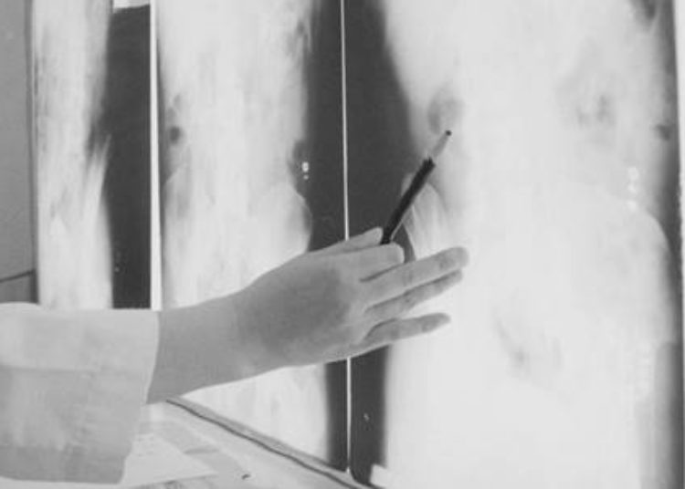 Radiologist recommendations often yield significant findings