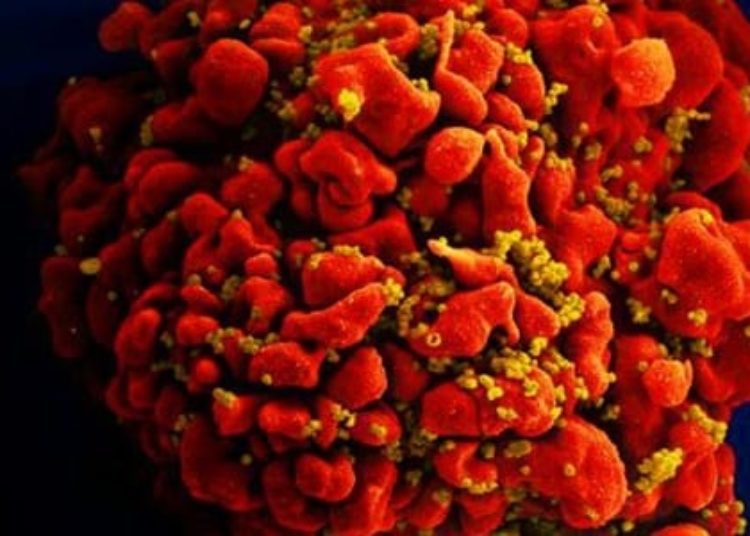 Use of injectable contraceptive, Depo-Provera, linked to increased risk of HIV