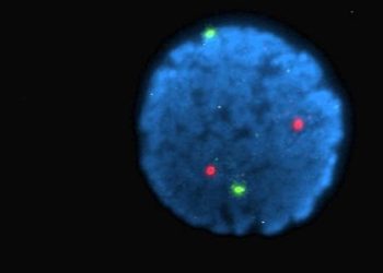 Fluorophores enhance visualization for image-guided surgery [PreClinical]