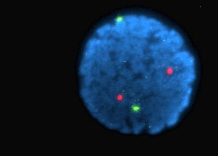 Fluorophores enhance visualization for image-guided surgery [PreClinical]