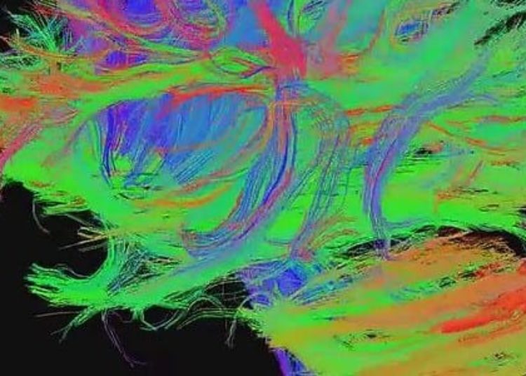Early removal from neglect may promote normal white matter development