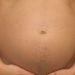Factors linked to viremia at delivery after pregnancy-initiated HAART