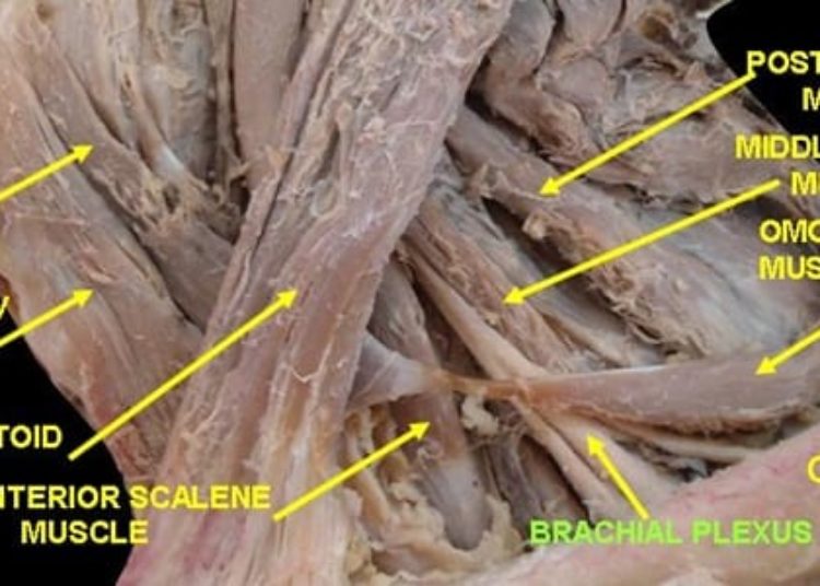 Bionic hand reconstruction shows initial promise in brachial plexus injuries