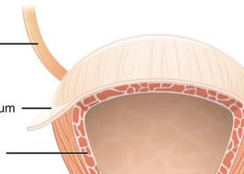 Minisling non-inferior to transobturator sling