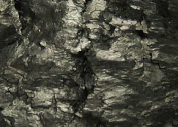 Intravenous gadolinium-based contrast agents may deposit in brain tissue