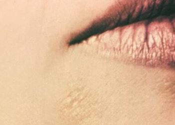 Gaps in provider identification of pediatric sex trafficking victims