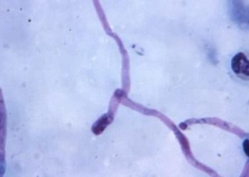 New vaccine shown to prevent a significant number of malaria cases in phase 3 trial