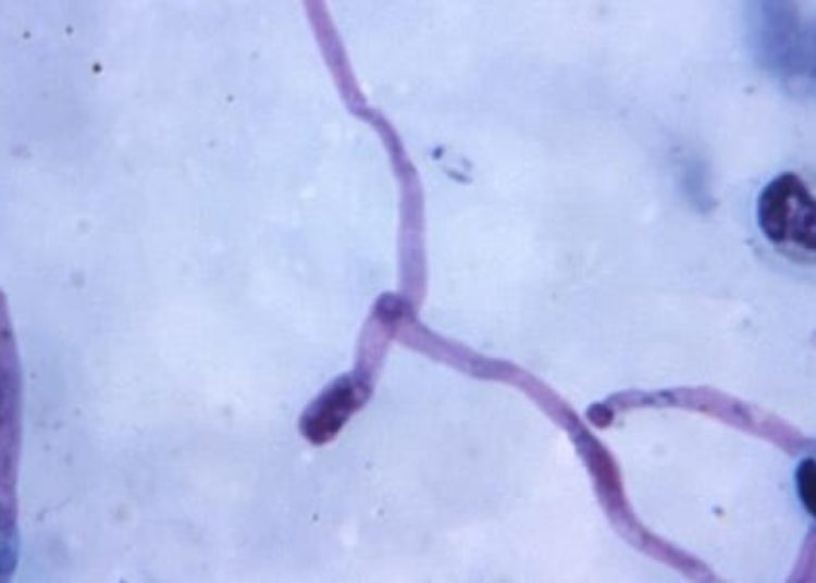 New vaccine shown to prevent a significant number of malaria cases in phase 3 trial