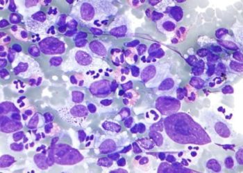 PET scans in early-stage Hodgkin’s lymphoma may help guide therapy [RAPID trial]