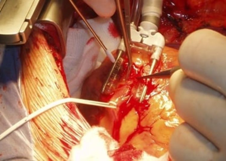 30-Day mortality decreased in UK pediatric cardiac surgery from 2000-2010