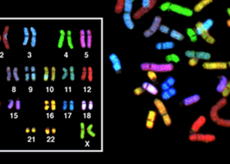 Non-invasive prenatal testing linked to decreased diagnostic testing