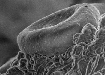 siRNA against antithrombin alleviates symptoms of hemophilia [PreClinical]