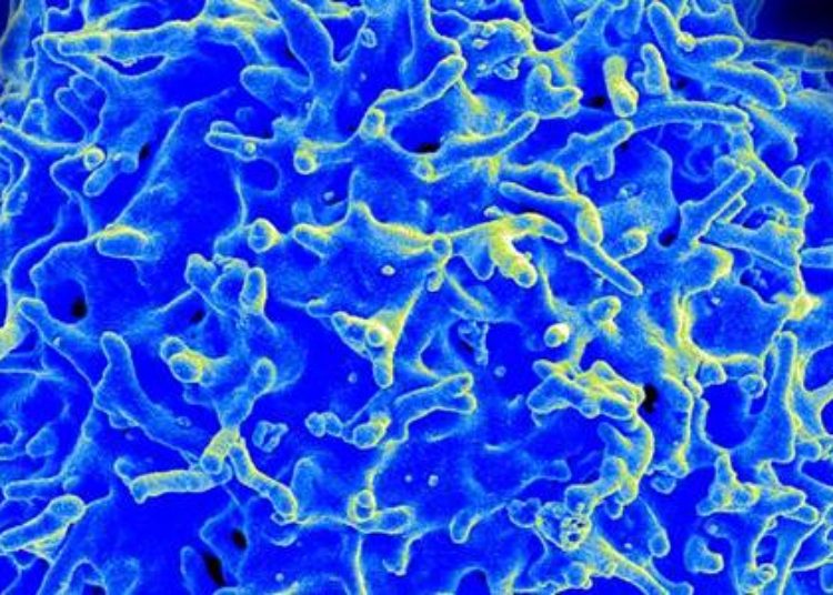 HPV-targeted T-cell therapy may induce cervical cancer regression